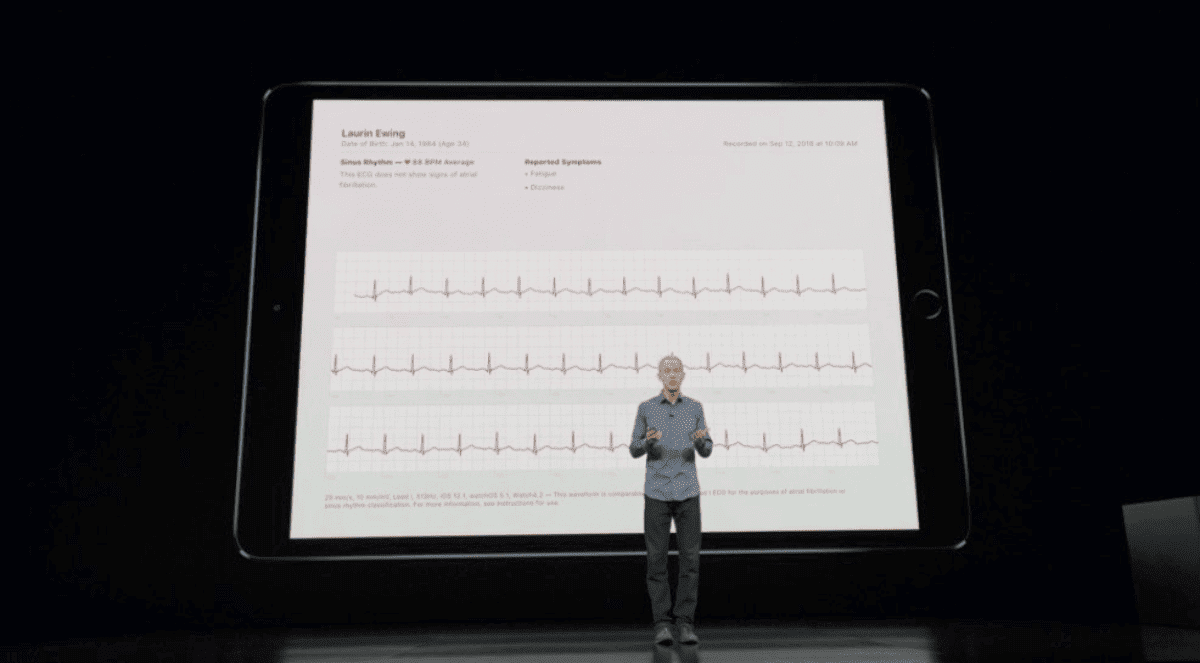Jeff Williams showing Apple Watch Series 4 electrocardiogram.