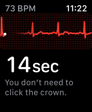 Screenshot of the ECG app