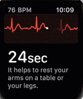 ecg on apple watch