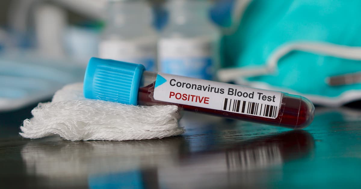 Vial of blood marked positive for coronavirus..