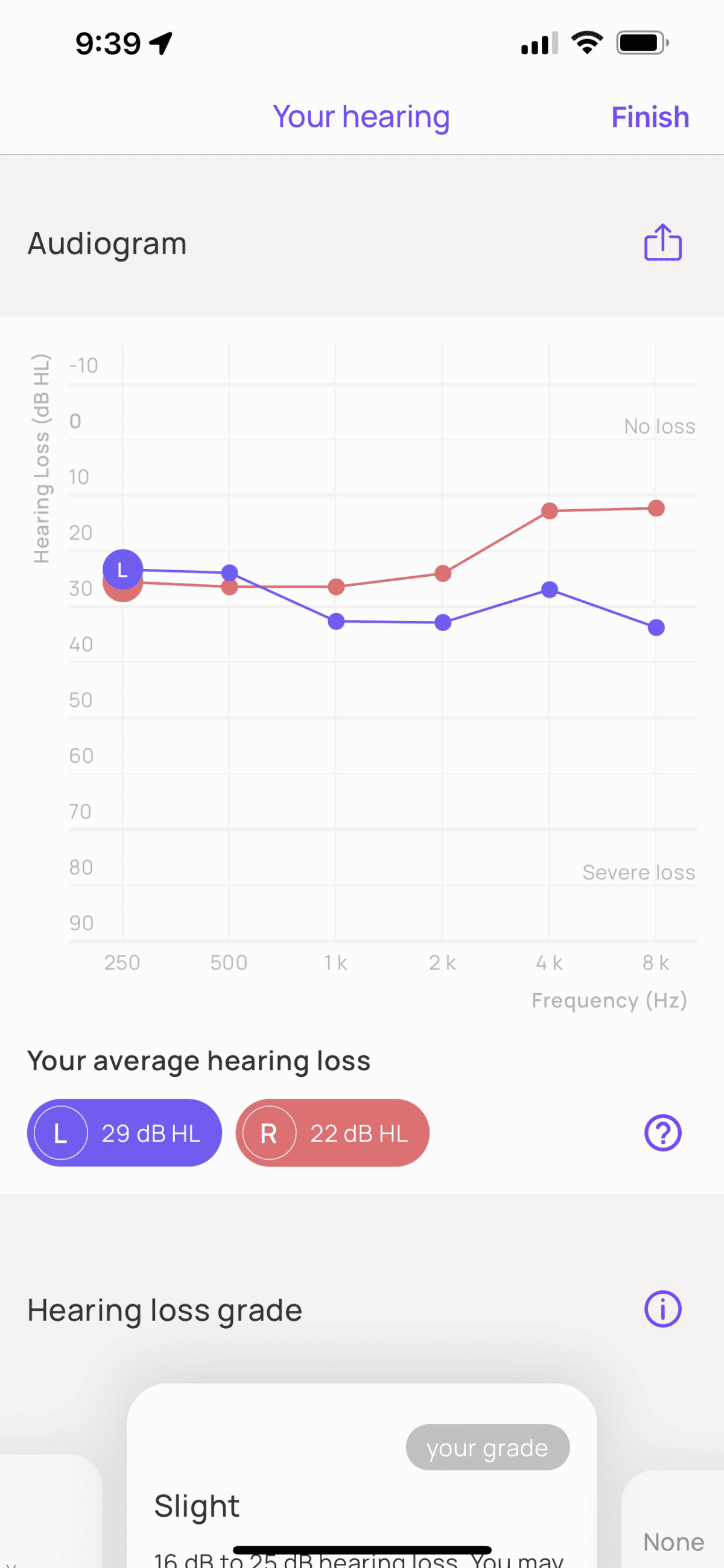 My audiogram (created by the Mimi app).