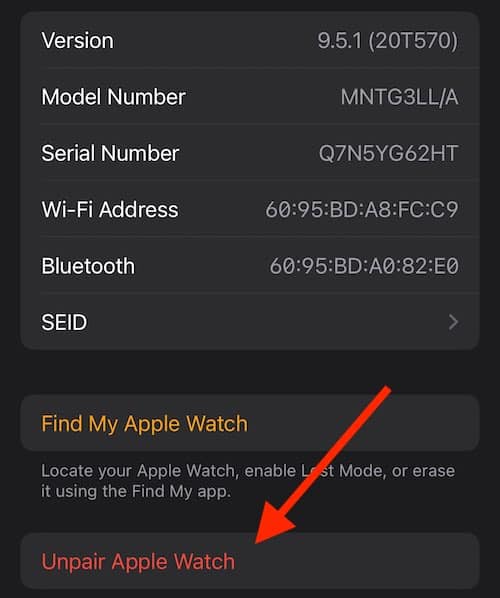 Select Unpair Apple Watch