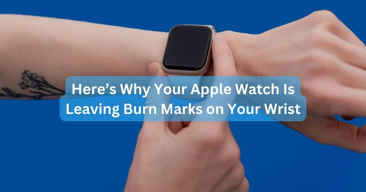Text Reasons Your Apple Watch is Leaving Burn Marks on Your Wrist over Smartwatch