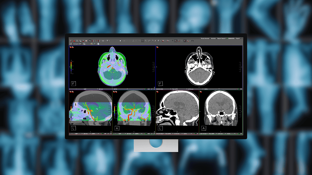 Studio Display XDR Brings Medical Imaging Presets to Radiologists
