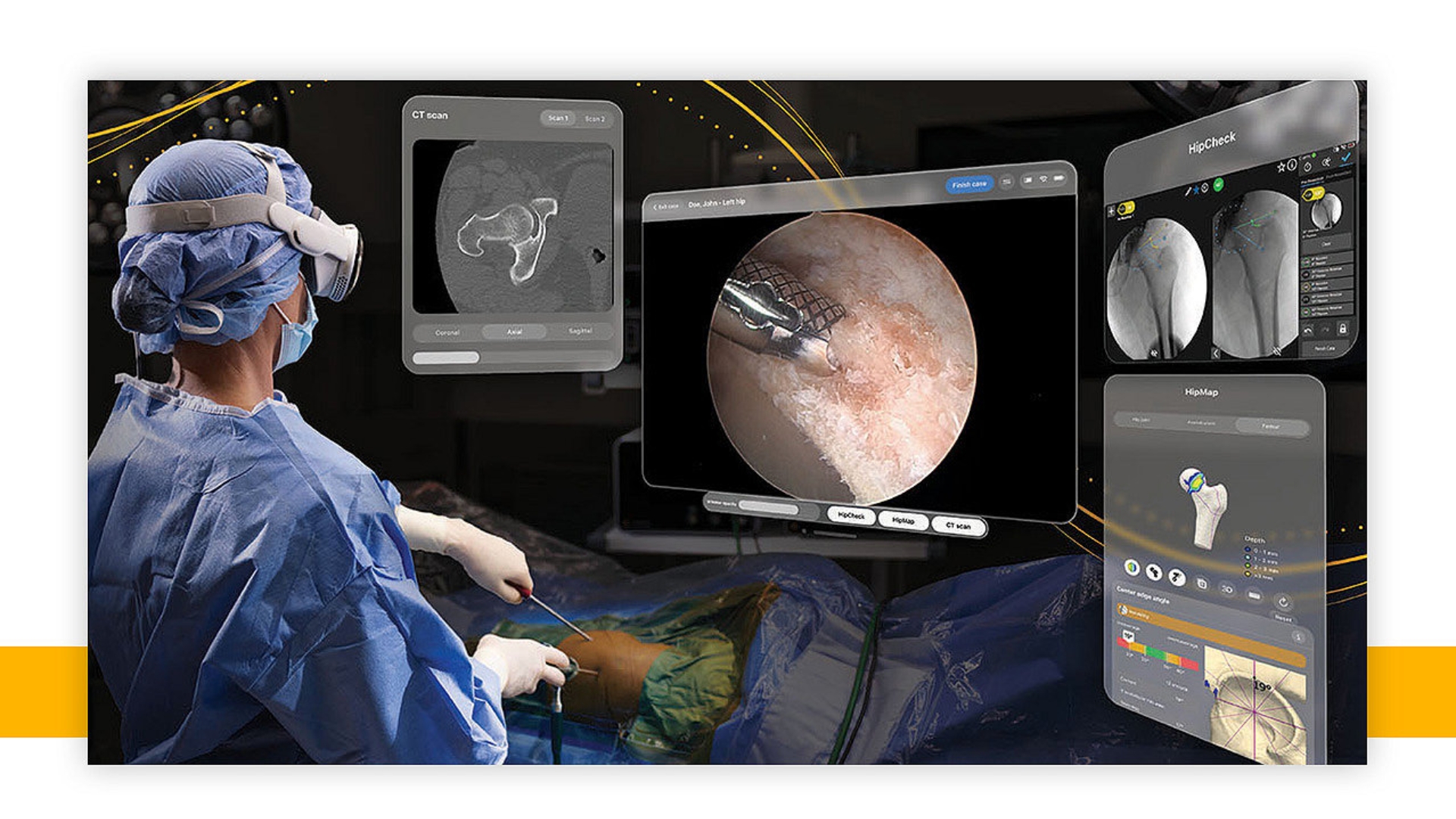 Apple Vision Pro Is Now Being Used During Surgery and Cancer Research Experiences